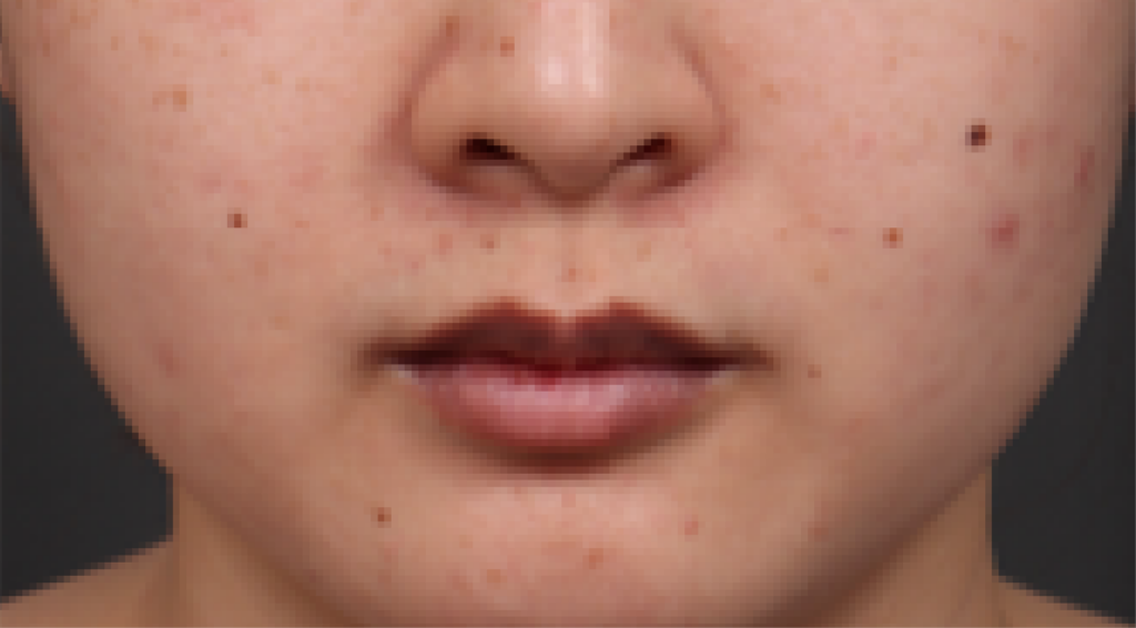 Before