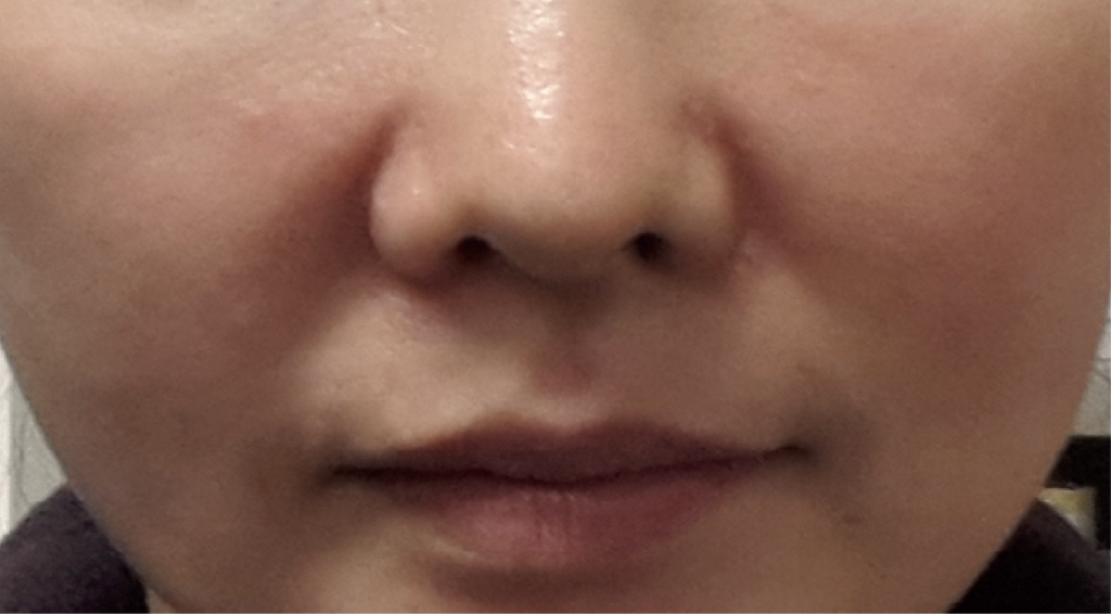 After 70 Days